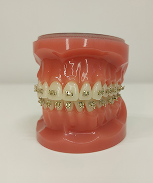 Iconix fiksne proteze