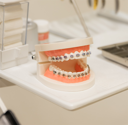 Izgled fiksnih proteza